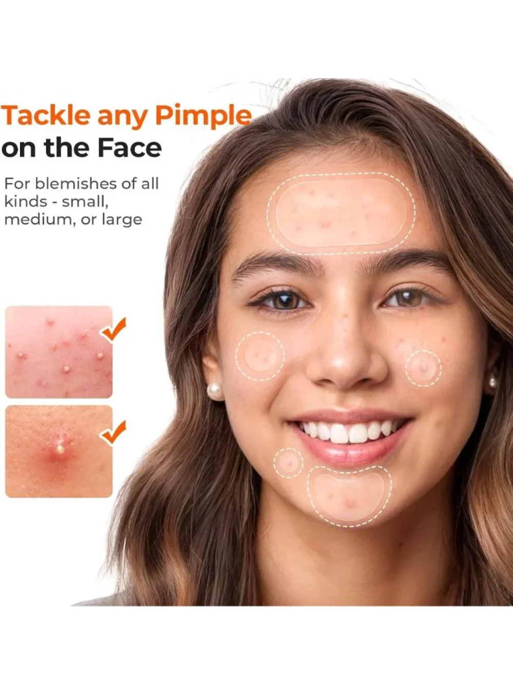Hydrocolloid Acne Pimple Patches - 443 Count Face Cover for Clear Skin
